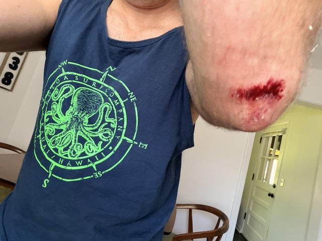 ate shit day 3