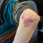 Learned what a nosedive is.