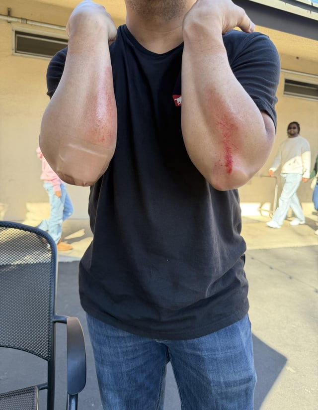 Finally ate it on my XRC, had wrist, helmet and knee guards.