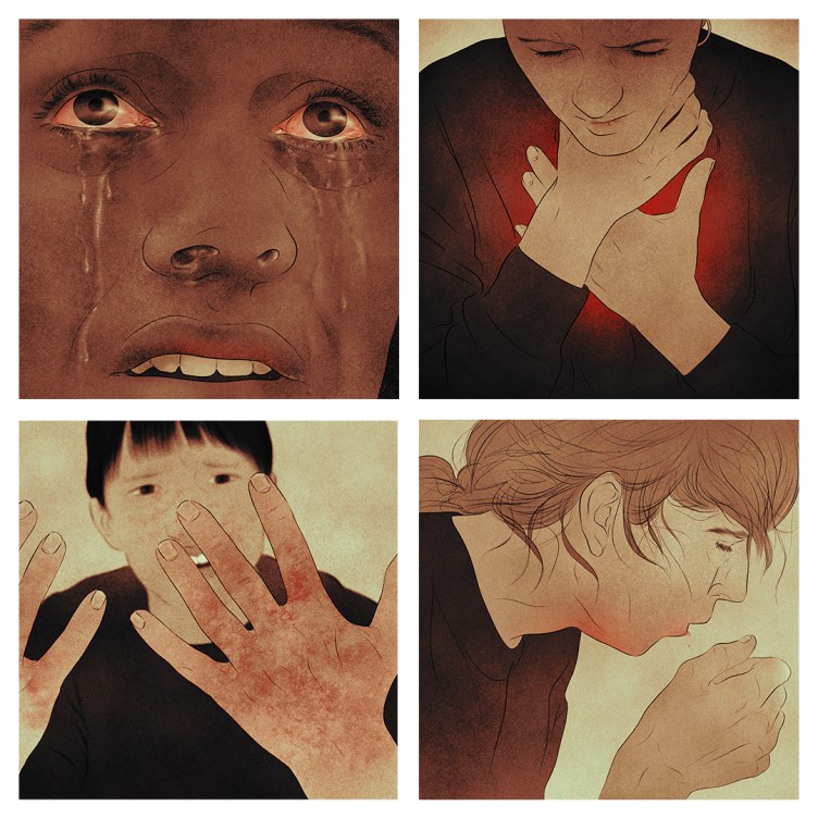 Clockwise from top left: A close-up illustration of a person’s face. Their eyes are red and tears are streaming down their cheeks. A person holds their throat with one hand and their chest with the other hand. Redness emanates from their chest. A person coughs into their hand. A person looks with an anguished expression at their hands, which are covered in a red rash.