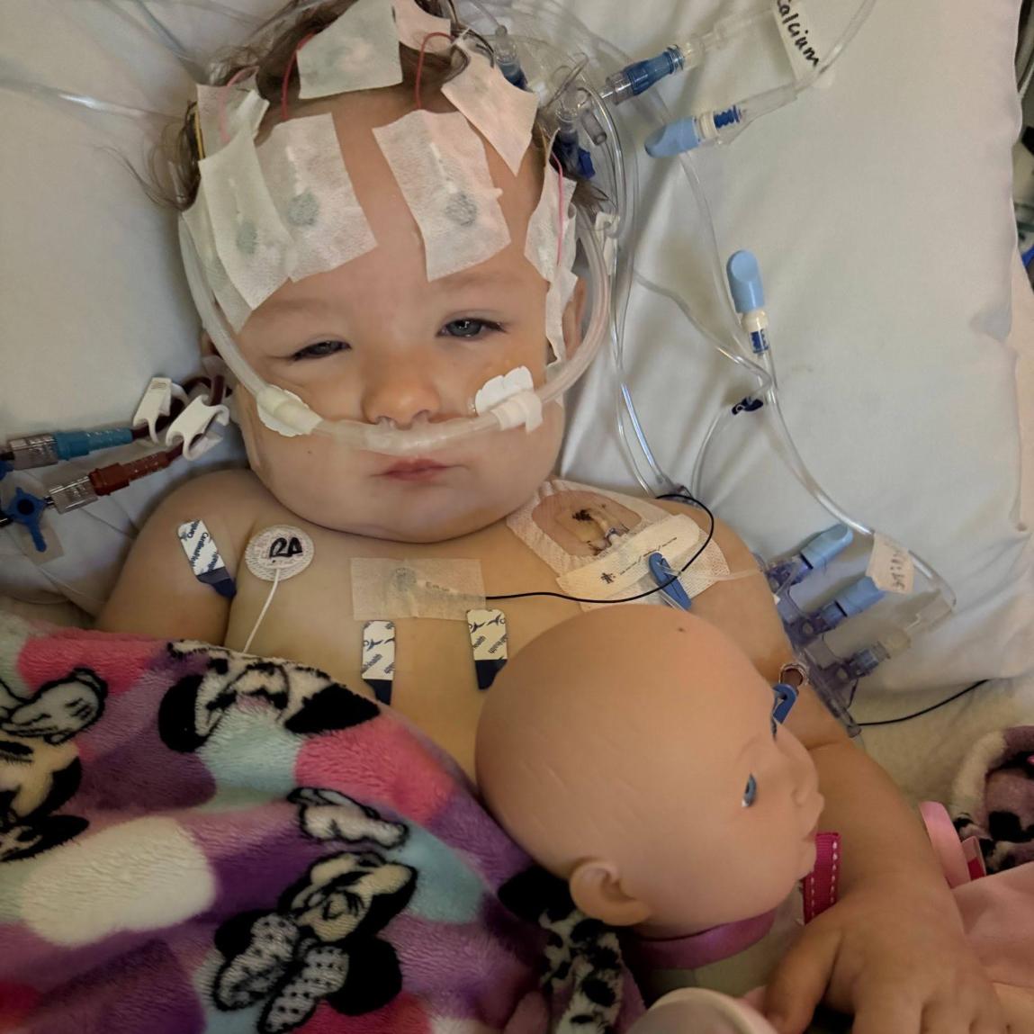 A toddler in a hospital bed with electrodes on her head and body, holding a baby doll.