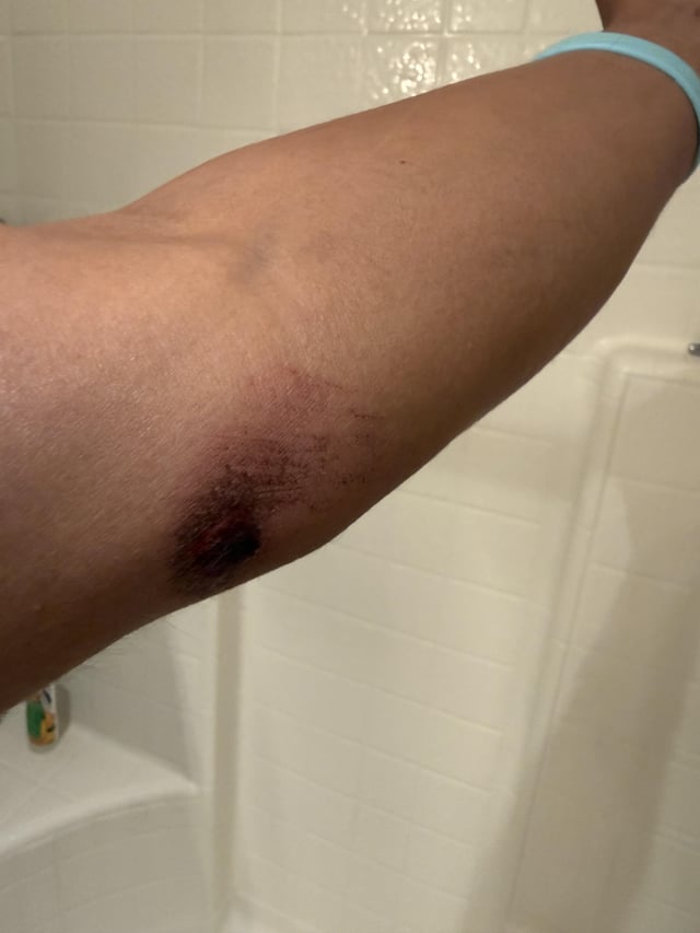 PSA: Always wear your safety gear